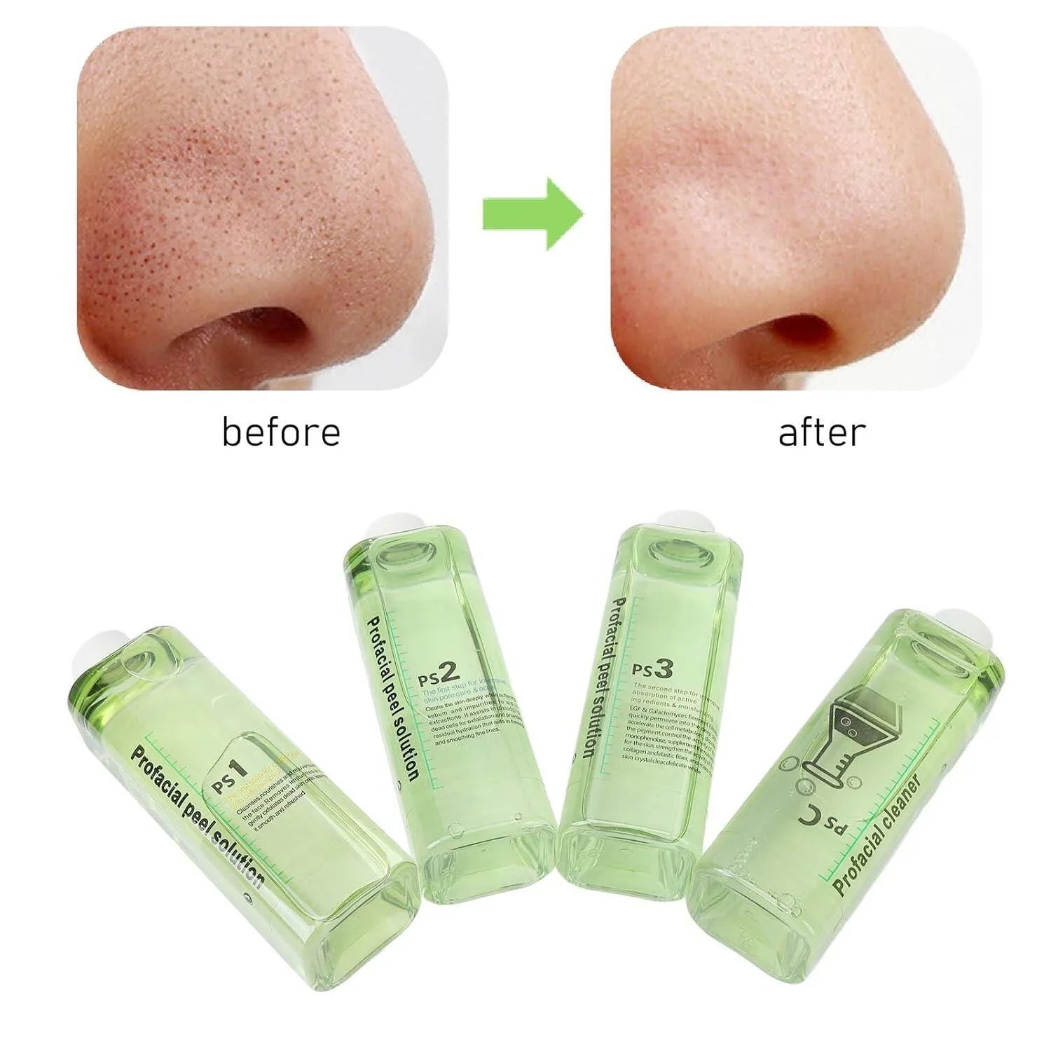 4pcs Hydra Peeling Facial Serum for Dermabrasion Device Deep Cleansing Hydro Dermabrasion Solution Daily Skin Care Brightening and Hydrating Facial Serum