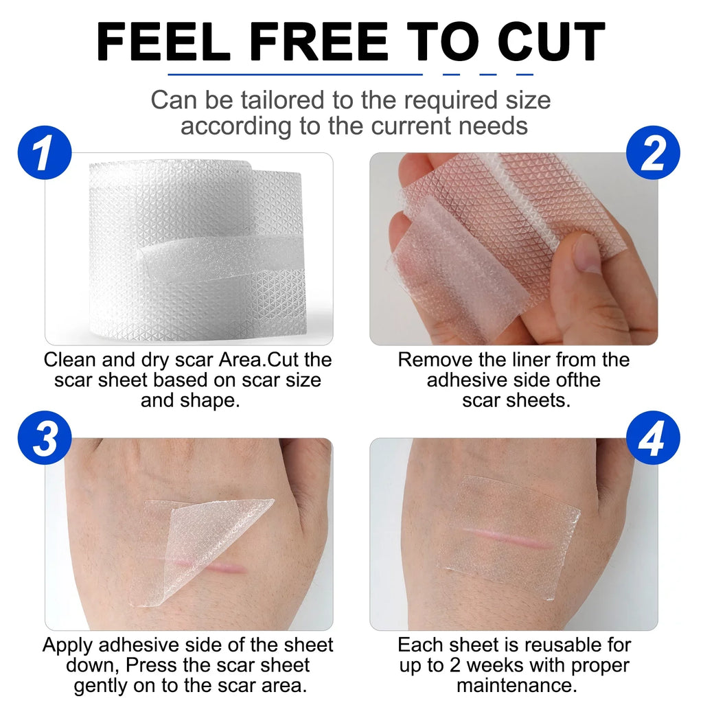 Pephuca Medical Grade Silicone Scar Sheets;Reusable and Breathable Silicone Gel Tape for Scar Removal;120inch x 1.6inch Roll Reusable 6 Months Supply;Transparent - 2 Pack
