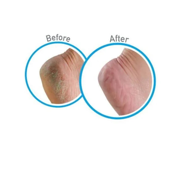 3oz. Healthy Feet Foot Cream (5-Pack)