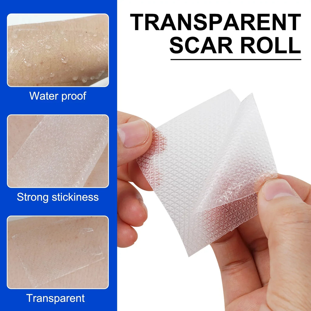 Pephuca Medical Grade Silicone Scar Sheets;Reusable and Breathable Silicone Gel Tape for Scar Removal;120inch x 1.6inch Roll Reusable 6 Months Supply;Transparent - 2 Pack