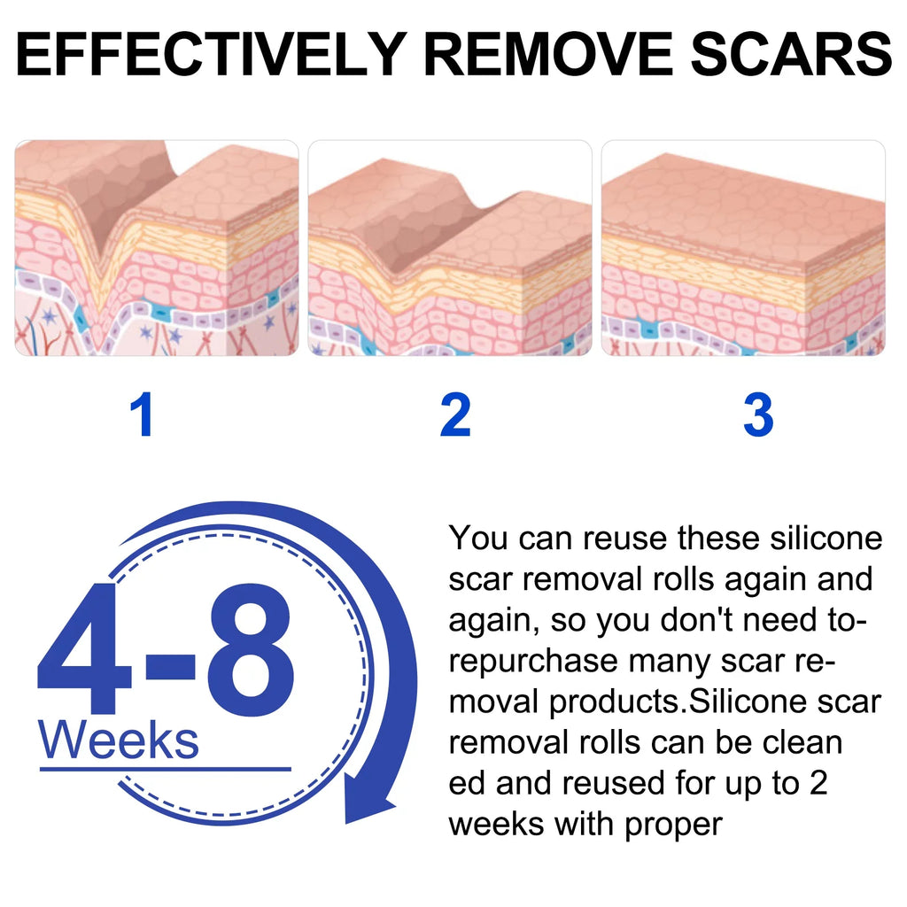 Pephuca Medical Grade Silicone Scar Sheets;Reusable and Breathable Silicone Gel Tape for Scar Removal;120inch x 1.6inch Roll Reusable 6 Months Supply;Transparent - 2 Pack